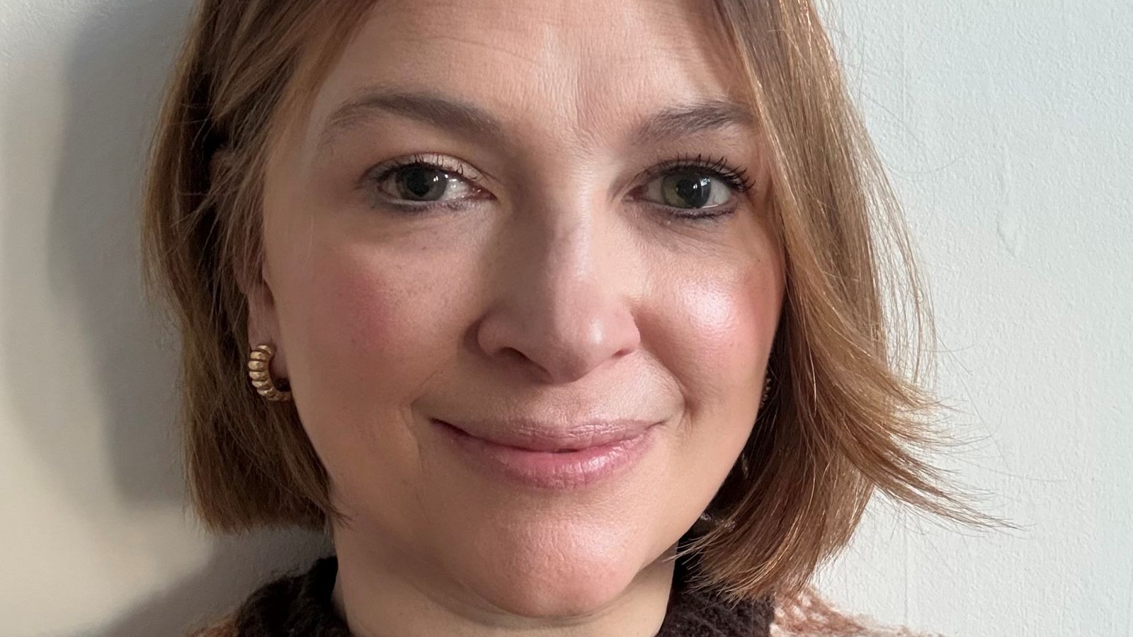 Low-Cost Eye Surgery Gel Restores Sight In Rare Hypotony Blindness Breakthrough, Researchers Say - SurgeZirc UK